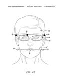 DEVICE, SYSTEM AND METHODS FOR DETERMINING AND MEASURING TEMPOROMANDIBULAR     JOINT POSITIONS AND MOVEMENTS diagram and image