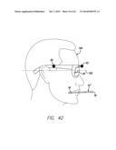 DEVICE, SYSTEM AND METHODS FOR DETERMINING AND MEASURING TEMPOROMANDIBULAR     JOINT POSITIONS AND MOVEMENTS diagram and image