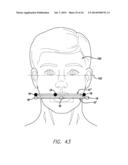 DEVICE, SYSTEM AND METHODS FOR DETERMINING AND MEASURING TEMPOROMANDIBULAR     JOINT POSITIONS AND MOVEMENTS diagram and image