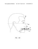 DEVICE, SYSTEM AND METHODS FOR DETERMINING AND MEASURING TEMPOROMANDIBULAR     JOINT POSITIONS AND MOVEMENTS diagram and image