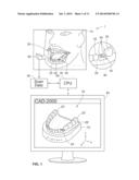 JIGS FOR PLACING DENTAL IMPLANT ANALOGS IN MODELS AND METHODS OF DOING THE     SAME diagram and image