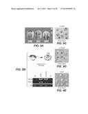 Compositions for Diagnosis and Therapy of Diseases Associated with     Aberrant Expression of Futrins (R-Spondins) and/or Wnt diagram and image