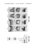 Compositions for Diagnosis and Therapy of Diseases Associated with     Aberrant Expression of Futrins (R-Spondins) and/or Wnt diagram and image