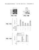 Compositions for Diagnosis and Therapy of Diseases Associated with     Aberrant Expression of Futrins (R-Spondins) and/or Wnt diagram and image