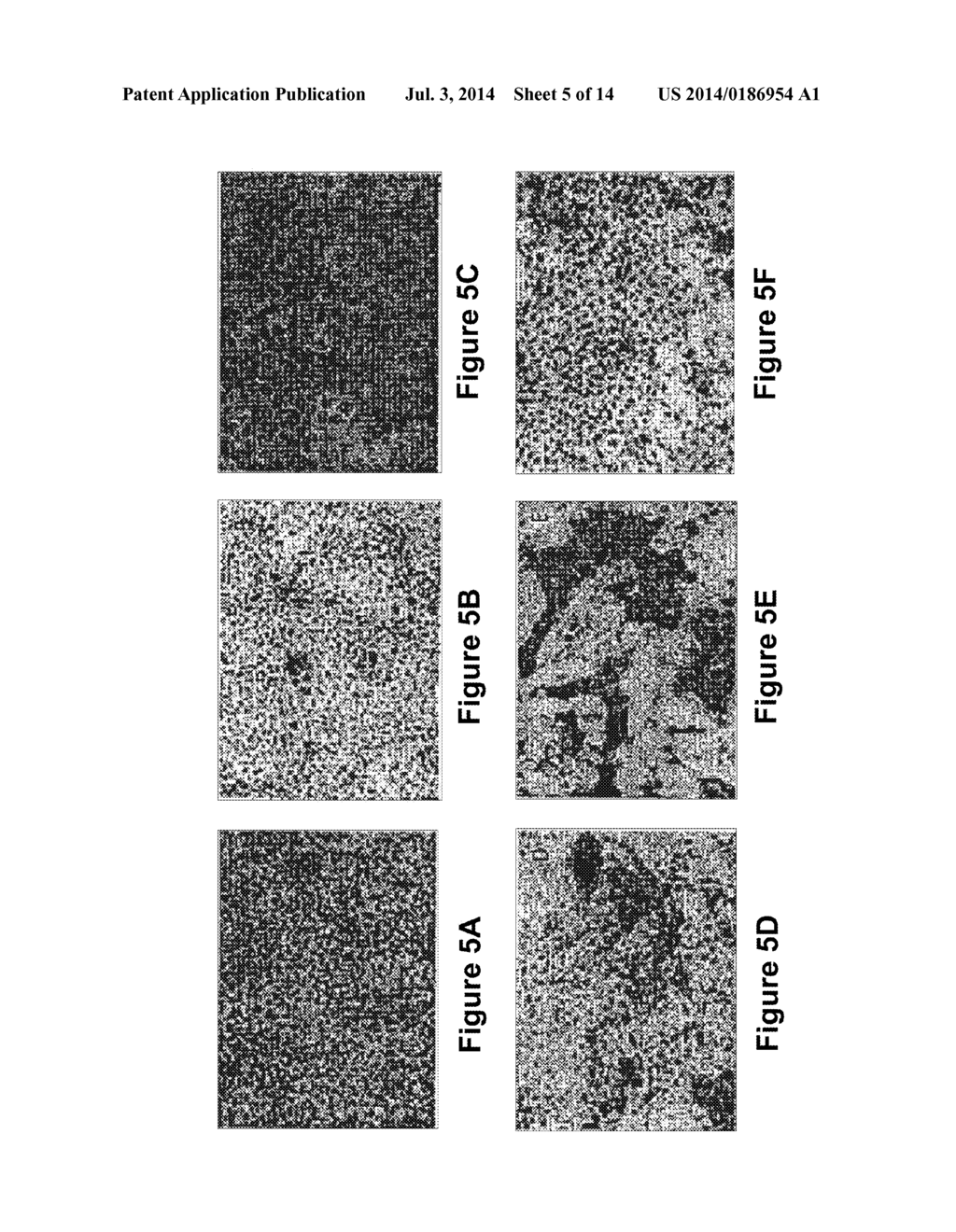 Optimized Methods for Differentiation of Cells Into Cells with Hepatocyte     and Hepatocyte Progenitor Phenotypes, Cells Produced by the Methods, and     Methods for Using the Cells - diagram, schematic, and image 06