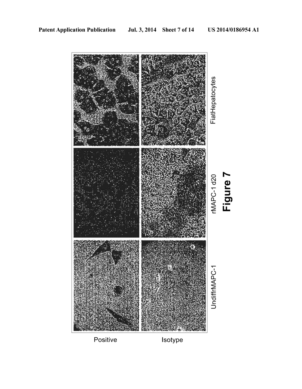 Optimized Methods for Differentiation of Cells Into Cells with Hepatocyte     and Hepatocyte Progenitor Phenotypes, Cells Produced by the Methods, and     Methods for Using the Cells - diagram, schematic, and image 08