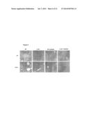 PREVENTION AND TREATMENT OF INFLAMMATORY CONDITIONS diagram and image