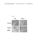 PREVENTION AND TREATMENT OF INFLAMMATORY CONDITIONS diagram and image