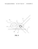 PARTICLE BEAM THERAPY SYSTEM diagram and image