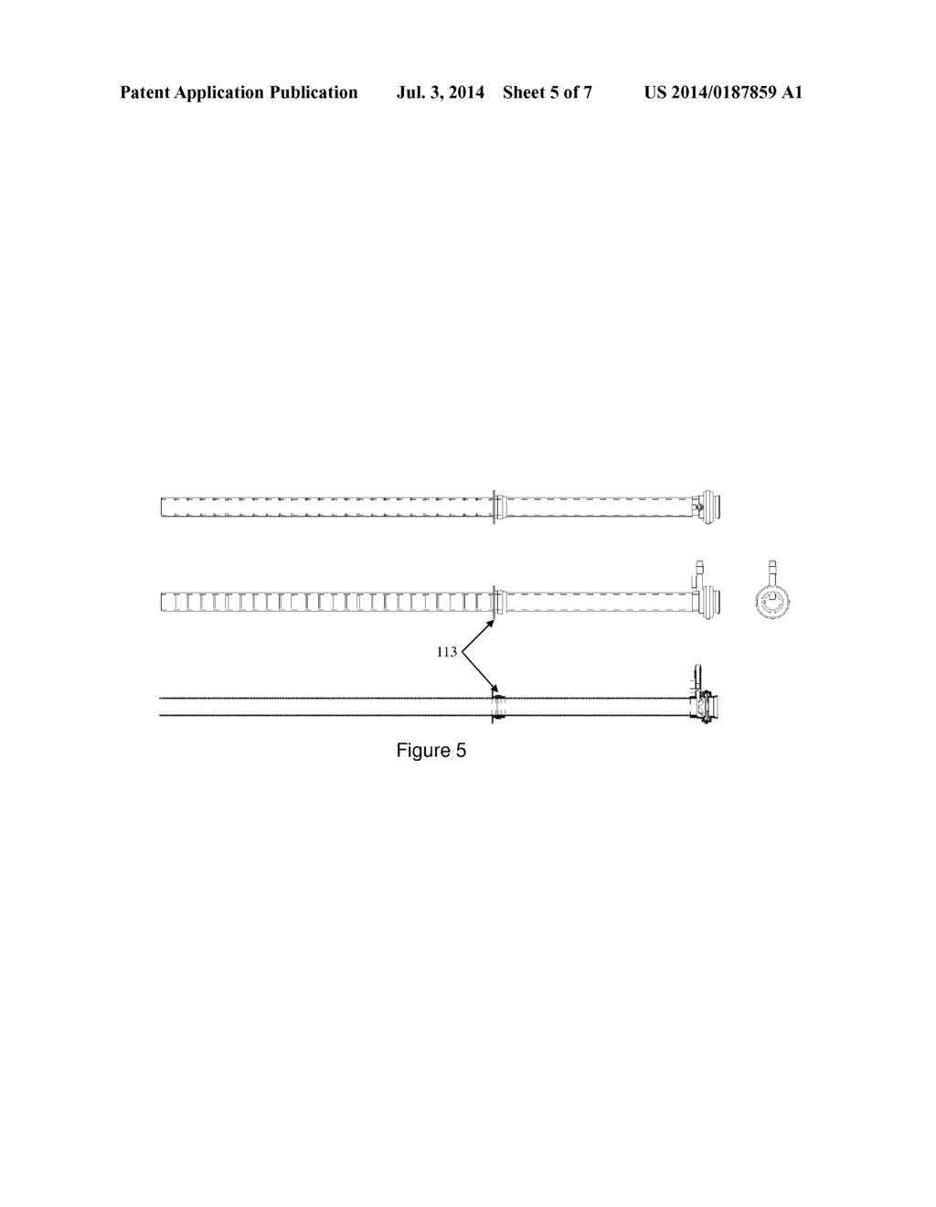 ENDOLUMINAL INTRODUCER - diagram, schematic, and image 06