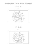 ENDOSCOPE SYSTEM, PROCESSING APPARATUS FOR THE SAME, AND IMAGE GENERATING     METHOD diagram and image