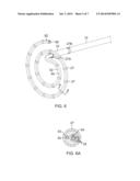 DOUBLE LOOP LASSO WITH SINGLE PULLER WIRE FOR BI-DIRECTIONAL ACTUATION diagram and image