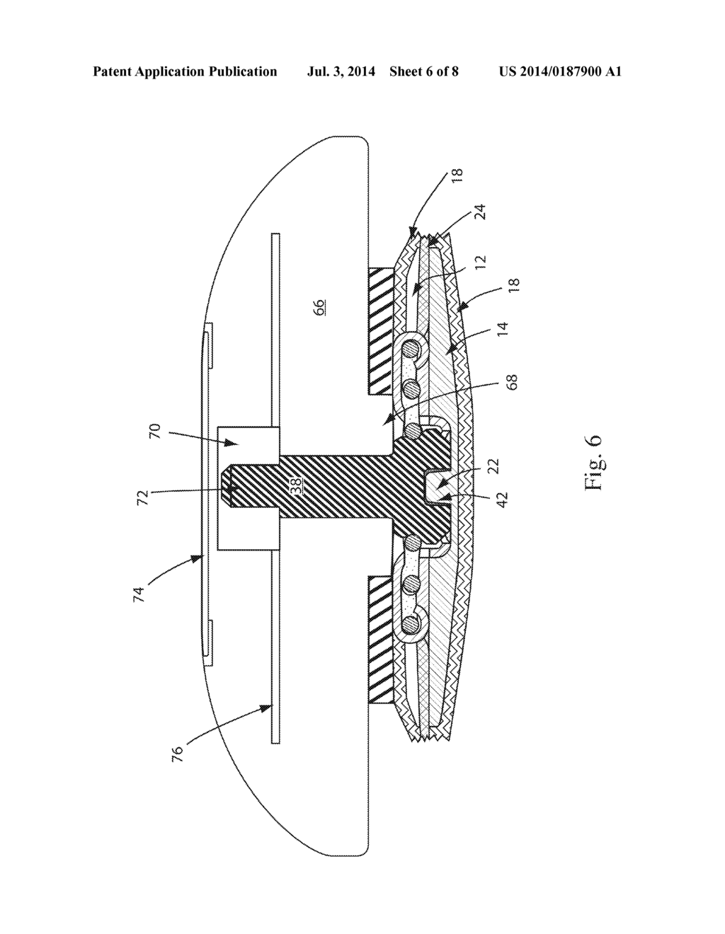 SNAP FOR INTEGRATION WITH A GARMENT - diagram, schematic, and image 07