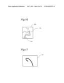 CATHETER TIP-END ROTATION ANGLE MEASUREMENT APPARATUS, CATHETER TIP-END     ROTATION ANGLE MEASUREMENT METHOD, AND CATHETER TIP-END ROTATION ANGLE     MEASUREMENT PROGRAM diagram and image