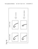 CATHETER TIP-END ROTATION ANGLE MEASUREMENT APPARATUS, CATHETER TIP-END     ROTATION ANGLE MEASUREMENT METHOD, AND CATHETER TIP-END ROTATION ANGLE     MEASUREMENT PROGRAM diagram and image