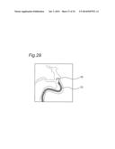 CATHETER TIP-END ROTATION ANGLE MEASUREMENT APPARATUS, CATHETER TIP-END     ROTATION ANGLE MEASUREMENT METHOD, AND CATHETER TIP-END ROTATION ANGLE     MEASUREMENT PROGRAM diagram and image