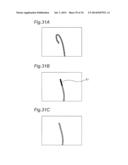 CATHETER TIP-END ROTATION ANGLE MEASUREMENT APPARATUS, CATHETER TIP-END     ROTATION ANGLE MEASUREMENT METHOD, AND CATHETER TIP-END ROTATION ANGLE     MEASUREMENT PROGRAM diagram and image