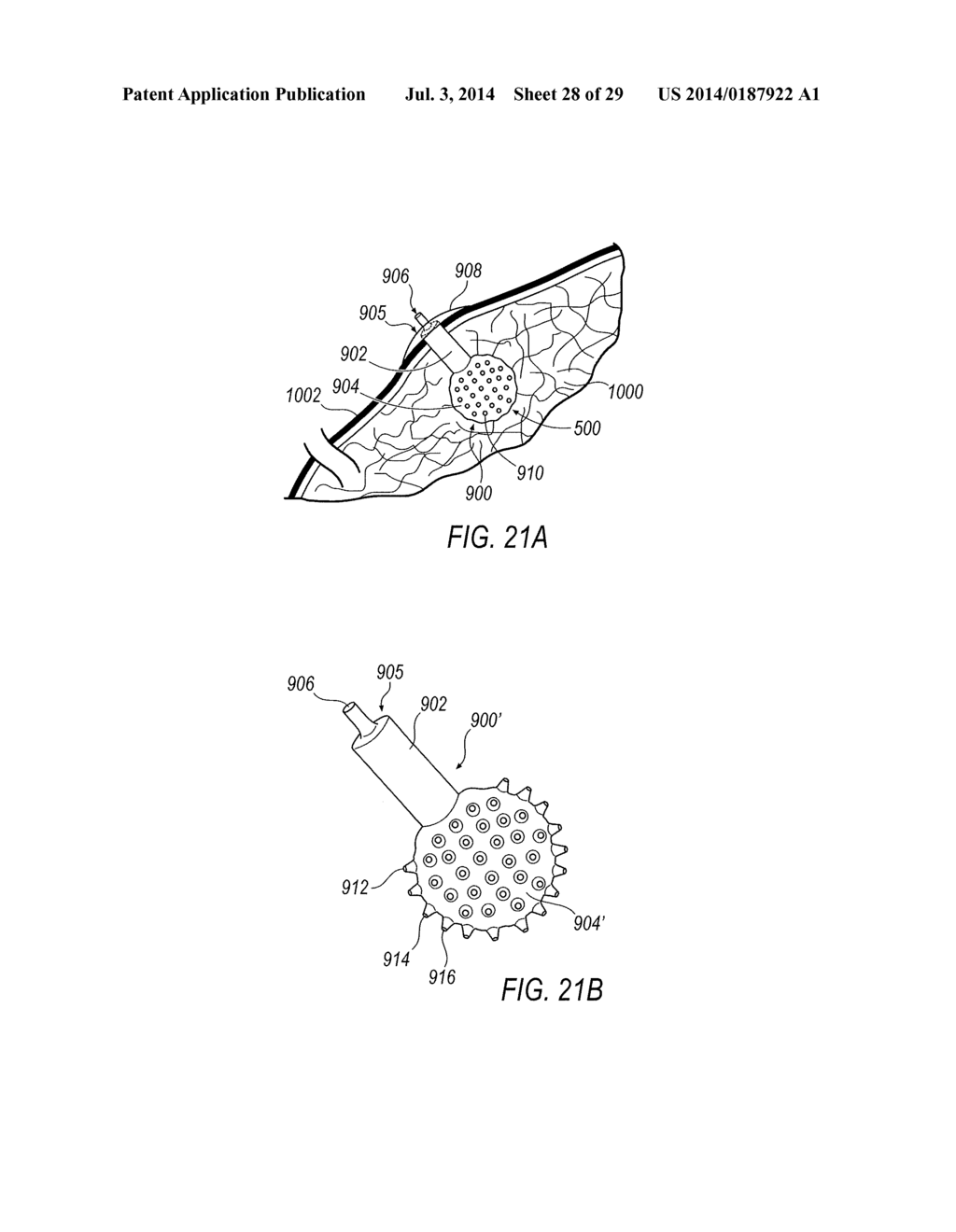 SURGICAL ACCESS SYSTEM WITH NAVIGATION ELEMENT AND METHOD OF USING SAME - diagram, schematic, and image 29