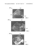 SYSTEMS AND METHODS FOR ULTRASOUND IMAGE RENDERING diagram and image