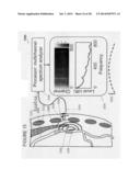 Spectrum analysis of coronary artery turbulent blood flow diagram and image