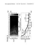 Spectrum analysis of coronary artery turbulent blood flow diagram and image