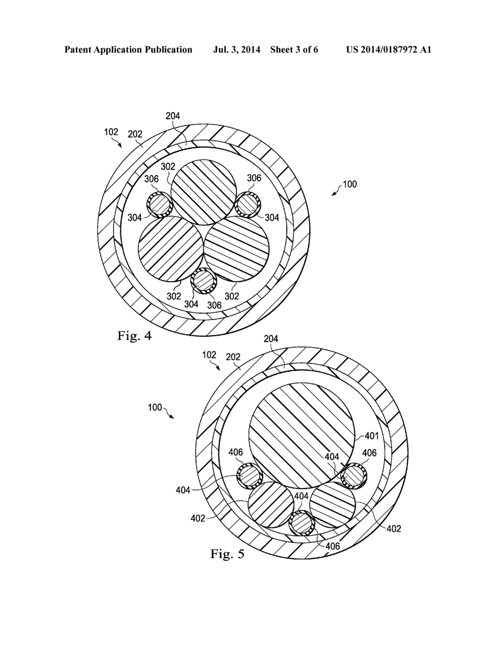 Guidewire Devices and Methods - diagram, schematic, and image 04