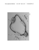 BODY-WORN SENSOR FOR CHARACTERIZING PATIENTS WITH HEART FAILURE diagram and image