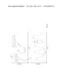 BODY-WORN SENSOR FOR CHARACTERIZING PATIENTS WITH HEART FAILURE diagram and image