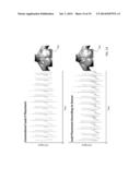 BODY-WORN SENSOR FOR CHARACTERIZING PATIENTS WITH HEART FAILURE diagram and image