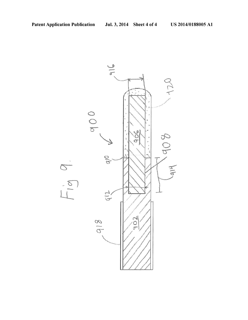 WIRE GUIDE AND METHOD OF MAKING THE SAME - diagram, schematic, and image 05