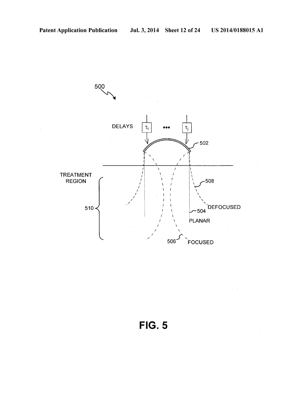 ENERGY-BASED TISSUE TIGHTENING SYSTEM - diagram, schematic, and image 13