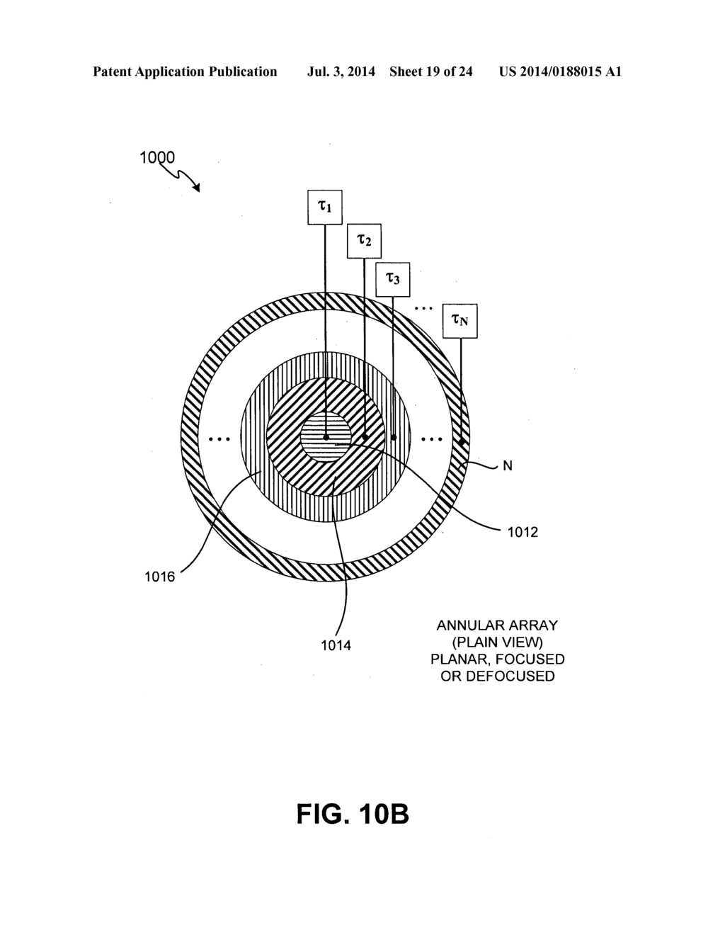 ENERGY-BASED TISSUE TIGHTENING SYSTEM - diagram, schematic, and image 20