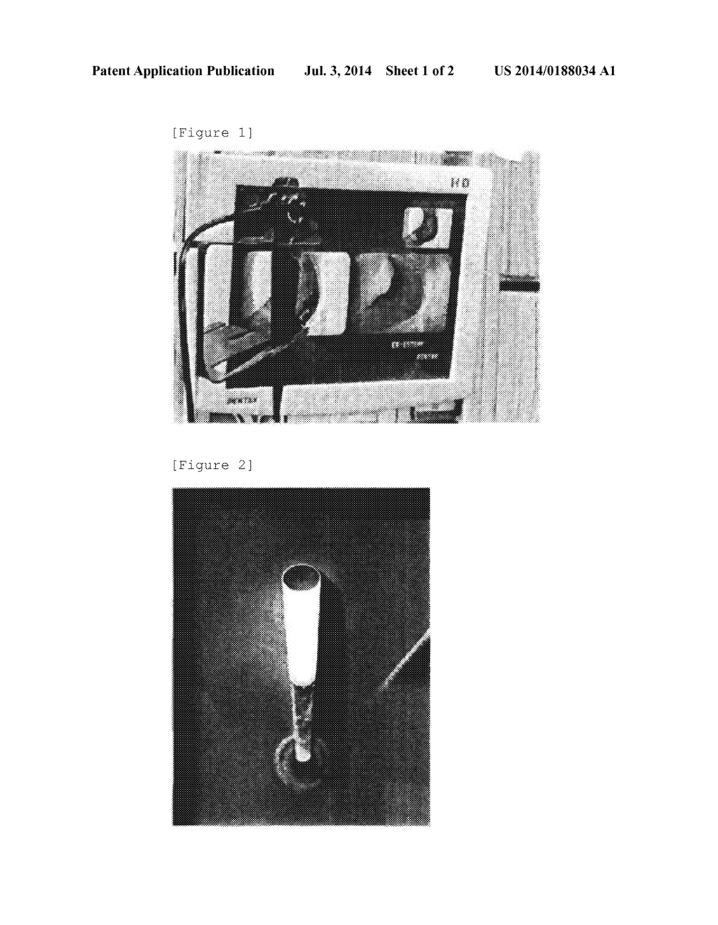 THERAPEUTIC AGENT FOR ALLERGIC RHINITIS - diagram, schematic, and image 02