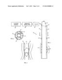 NASOGASTRIC TUBE diagram and image