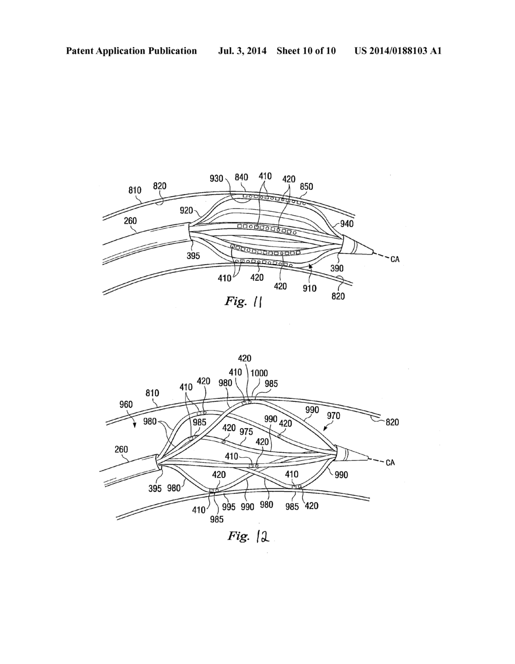 Methods and Apparatus for Neuromodulation Utilizing Optical-Acoustic     Sensors - diagram, schematic, and image 11