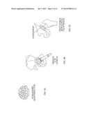 MEDICAL REAMERS AND METHODS OF FORMING THE SAME diagram and image