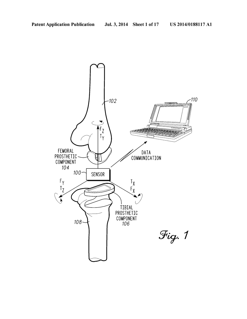 Shielded Capacitor Sensor System For Medical Applications And Method - diagram, schematic, and image 02