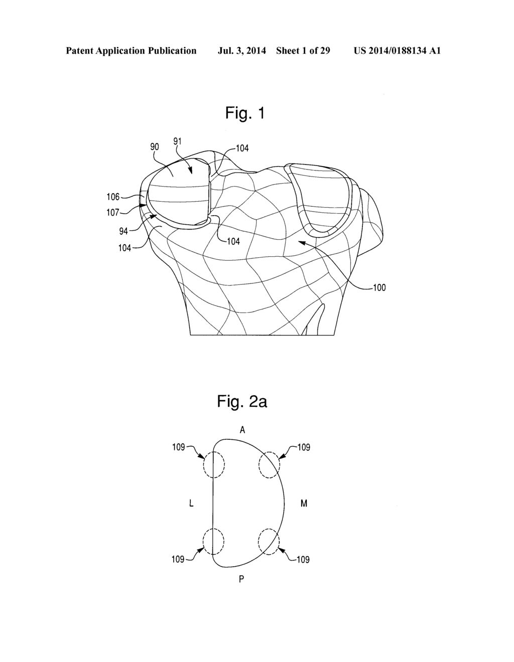 PROSTHETIC DEVICE, METHOD OF PLANNING BONE REMOVAL FOR IMPLANTATION OF     PROSTHETIC DEVICE, AND ROBOTIC SYSTEM - diagram, schematic, and image 02