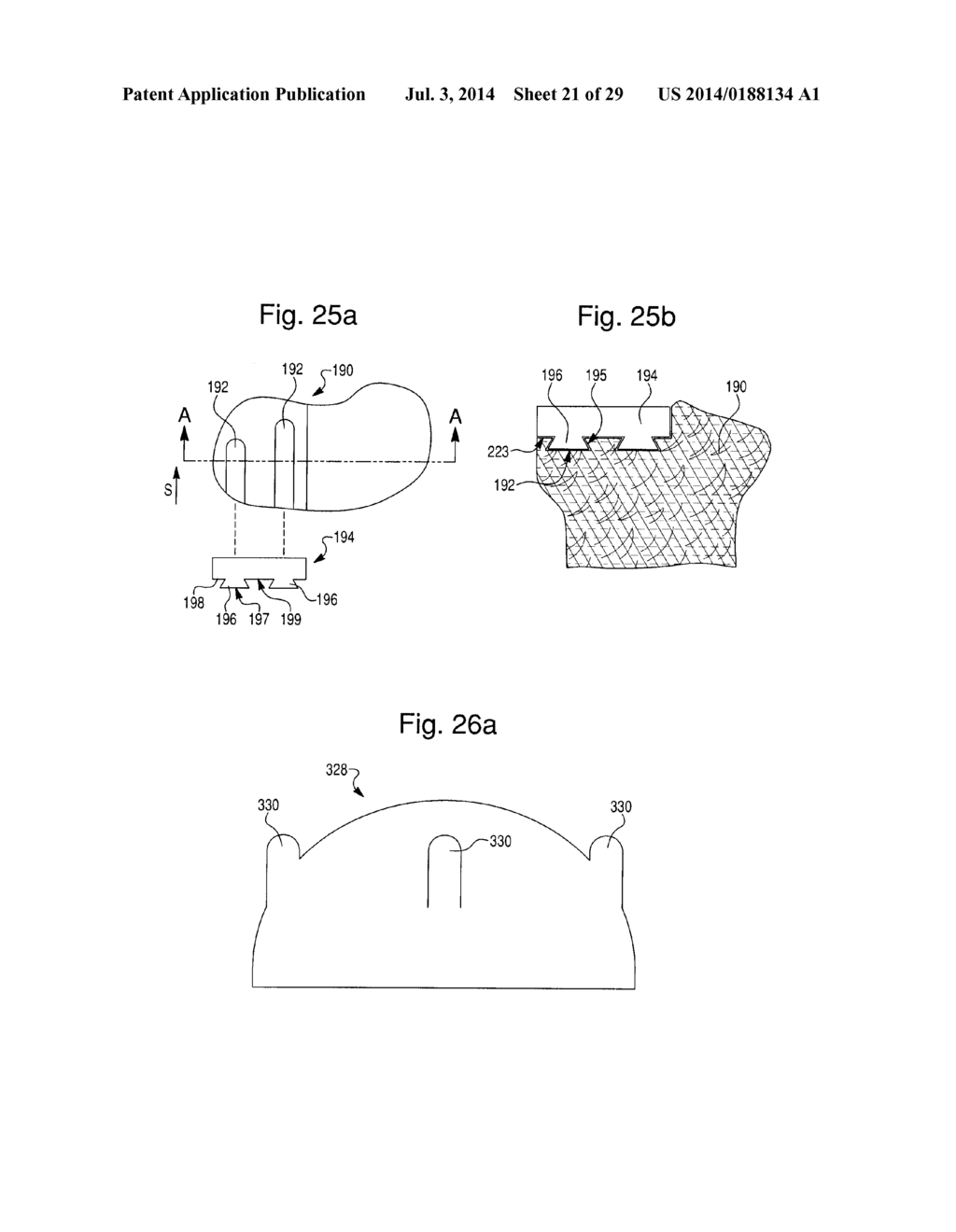 PROSTHETIC DEVICE, METHOD OF PLANNING BONE REMOVAL FOR IMPLANTATION OF     PROSTHETIC DEVICE, AND ROBOTIC SYSTEM - diagram, schematic, and image 22