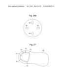 PROSTHETIC DEVICE, METHOD OF PLANNING BONE REMOVAL FOR IMPLANTATION OF     PROSTHETIC DEVICE, AND ROBOTIC SYSTEM diagram and image