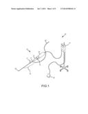 STEERABLE ULTRASOUND CATHETER diagram and image