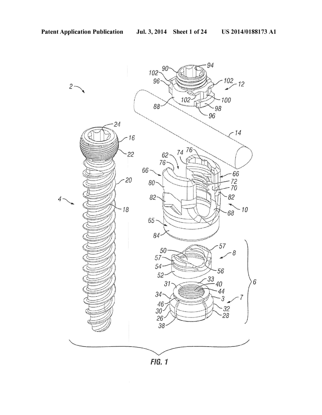 Orthopedic Fixation Devices and Methods of Installation Thereof - diagram, schematic, and image 02