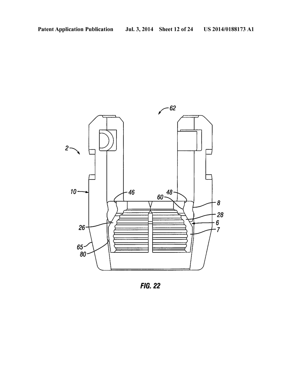 Orthopedic Fixation Devices and Methods of Installation Thereof - diagram, schematic, and image 13