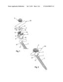 ANCHORING MEMBER SUITABLE FOR USE IN A POLYAXIAL BONE ANCHORING DEVICE AND     POLYAXIAL BONE ANCHORING DEVICE WITH AN ENLARGED PIVOT ANGLE TO ONE SIDE diagram and image