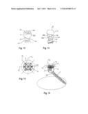 ANCHORING MEMBER SUITABLE FOR USE IN A POLYAXIAL BONE ANCHORING DEVICE AND     POLYAXIAL BONE ANCHORING DEVICE WITH AN ENLARGED PIVOT ANGLE TO ONE SIDE diagram and image