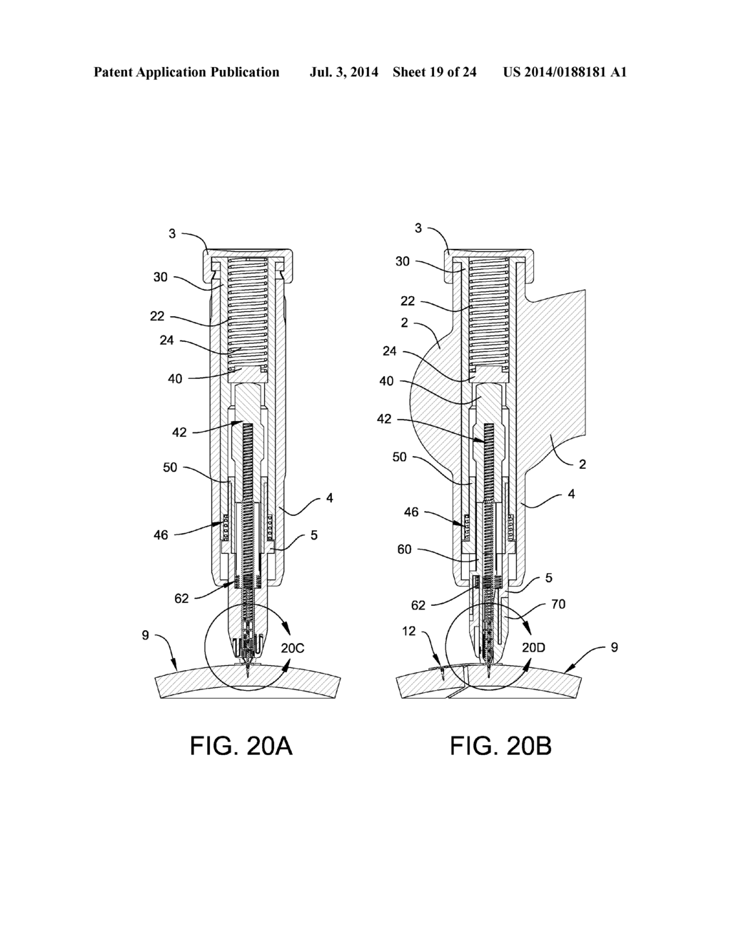 Apparatus and Device for the Fixation of Osteosynthesis Plates - diagram, schematic, and image 20