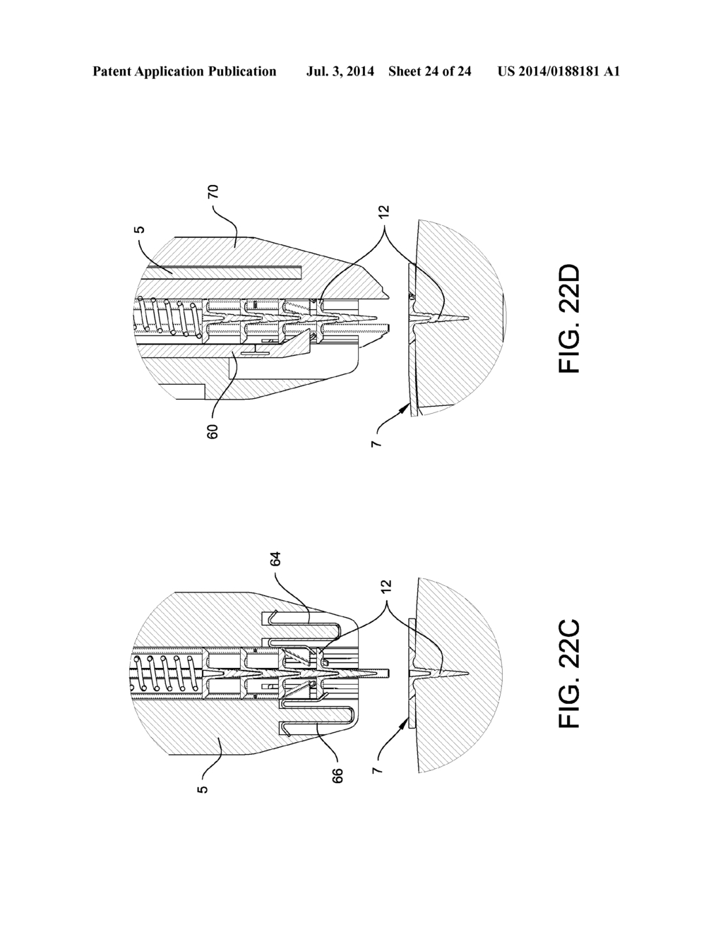 Apparatus and Device for the Fixation of Osteosynthesis Plates - diagram, schematic, and image 25