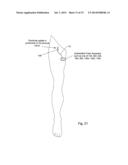 POSTERIOR TIBIAL NERVE AND/OR OTHER NERVE STIMULATION SYSTEM AND METHOD diagram and image