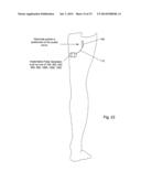 POSTERIOR TIBIAL NERVE AND/OR OTHER NERVE STIMULATION SYSTEM AND METHOD diagram and image