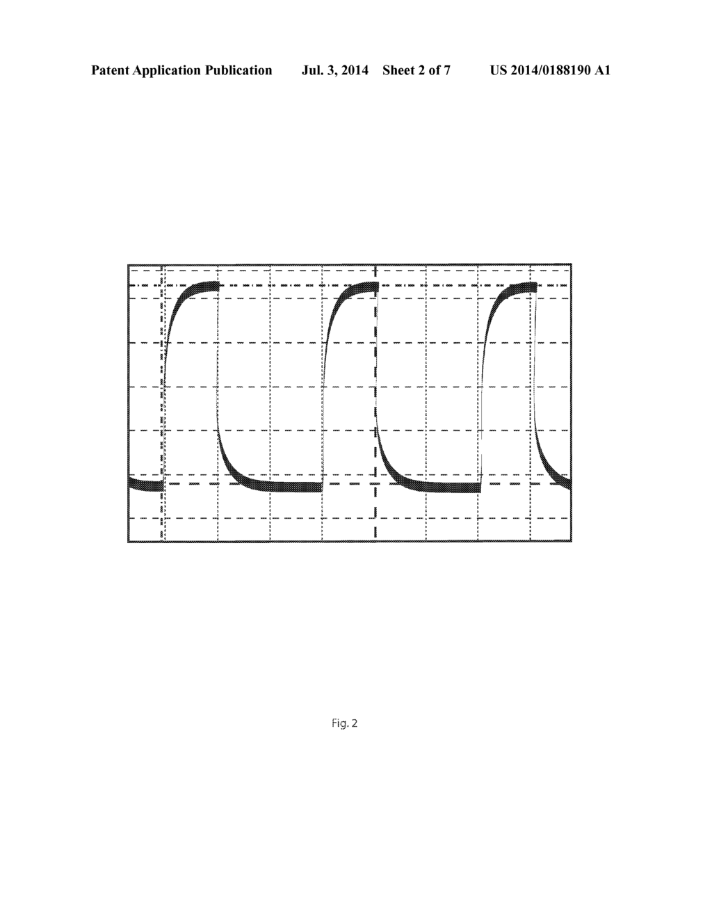 TRANSCUTANEOUS ELECTRICAL STIMULATION WAVEFORM GENERATOR AND METHOD OF USE - diagram, schematic, and image 03